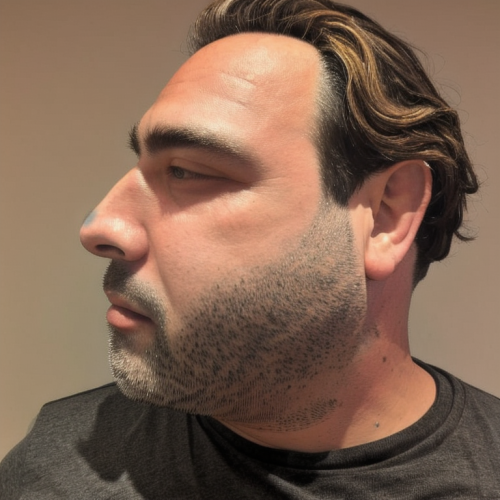 00004-2884086441