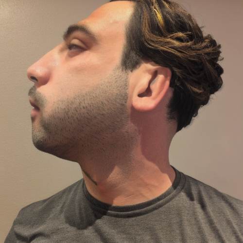 00006-2884086443